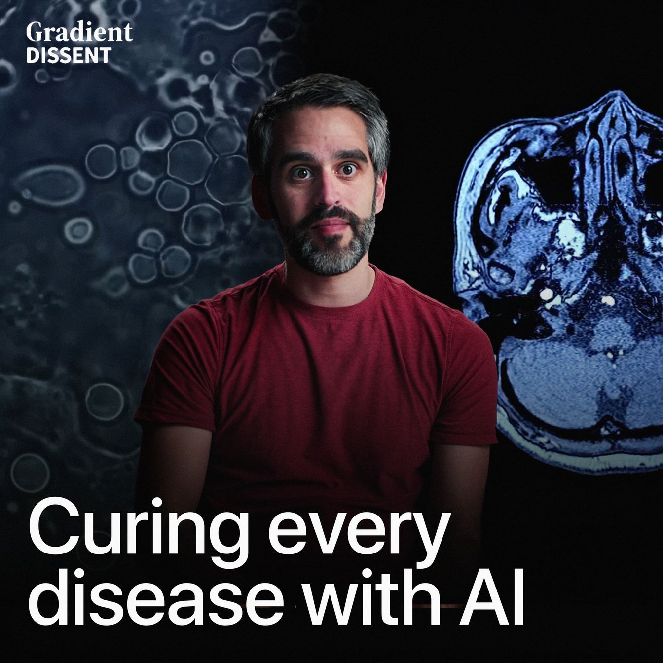 AI's Role in Drug Discovery: Overcoming Biology's Talent Bottleneck