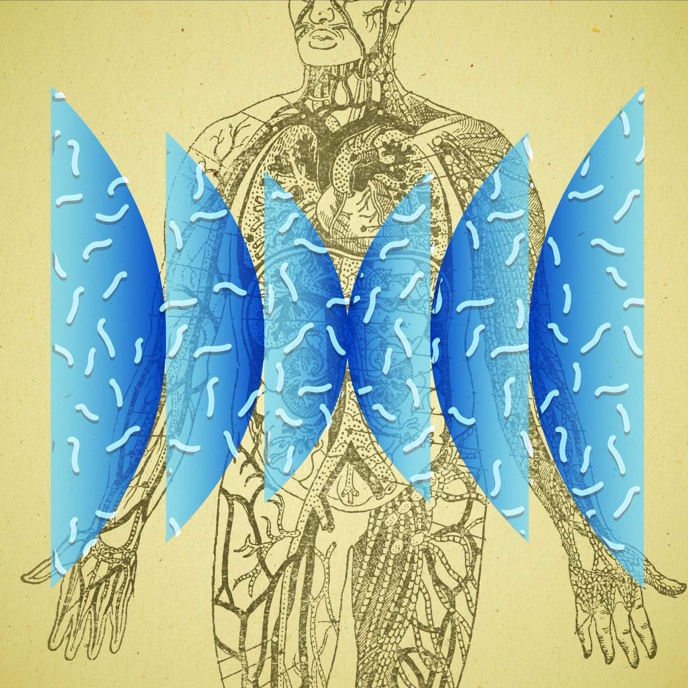 Parasites' Resurgence: Unintended Consequences of Immune System Dysregulation