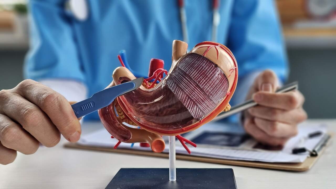 Genetic Discovery Forces Agonizing Choices Between Disease and Surgery