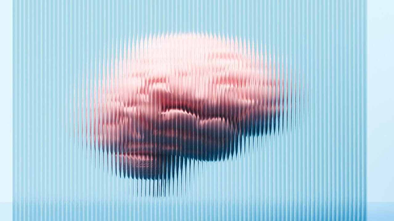 Functional Neurological Disorder Exposes Medical Silos and Need for Integrated Care